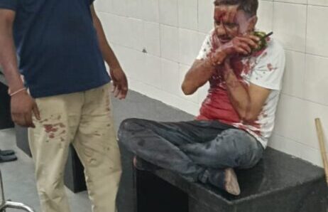 बरेलीरोड तीन पानी चौराहा सोनिया गार्डन के पास दो टैम्पो आपस में भिड़े